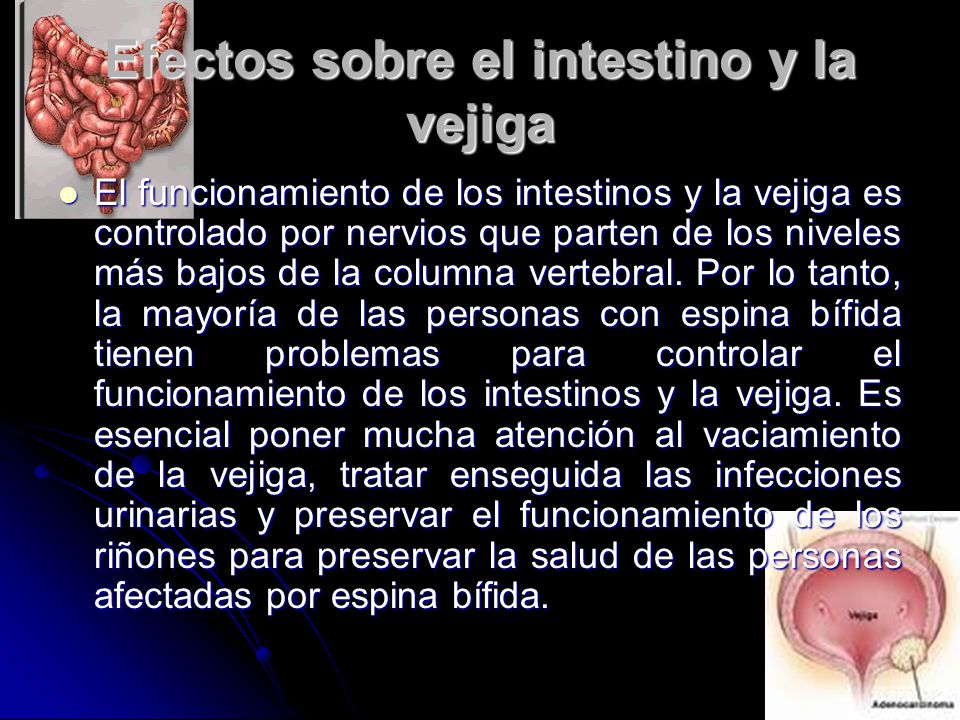 Los bragueros para el enderezamiento de la presencia